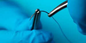 Sutura simples e técnica de anestesia local para Enfermeiros e estudantes de Enfermagem • Intensivo