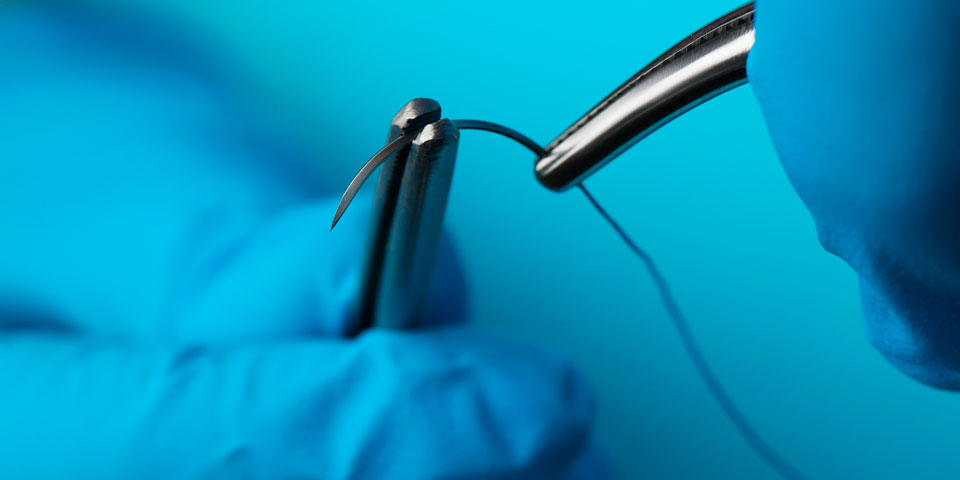 Sutura simples e técnica de anestesia local para Enfermeiros e estudantes de Enfermagem • Intensivo